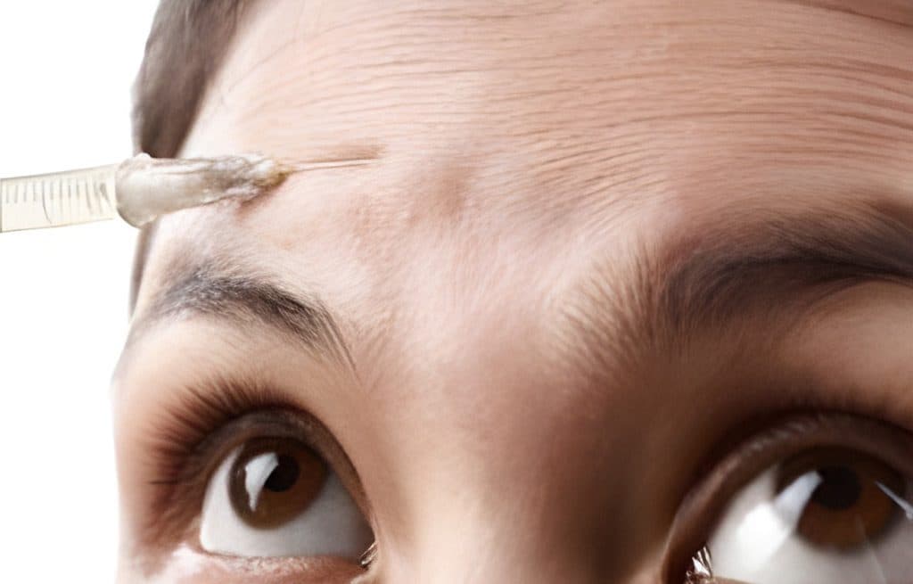 Ihre Haut in besten Händen: Botox Nürnberg