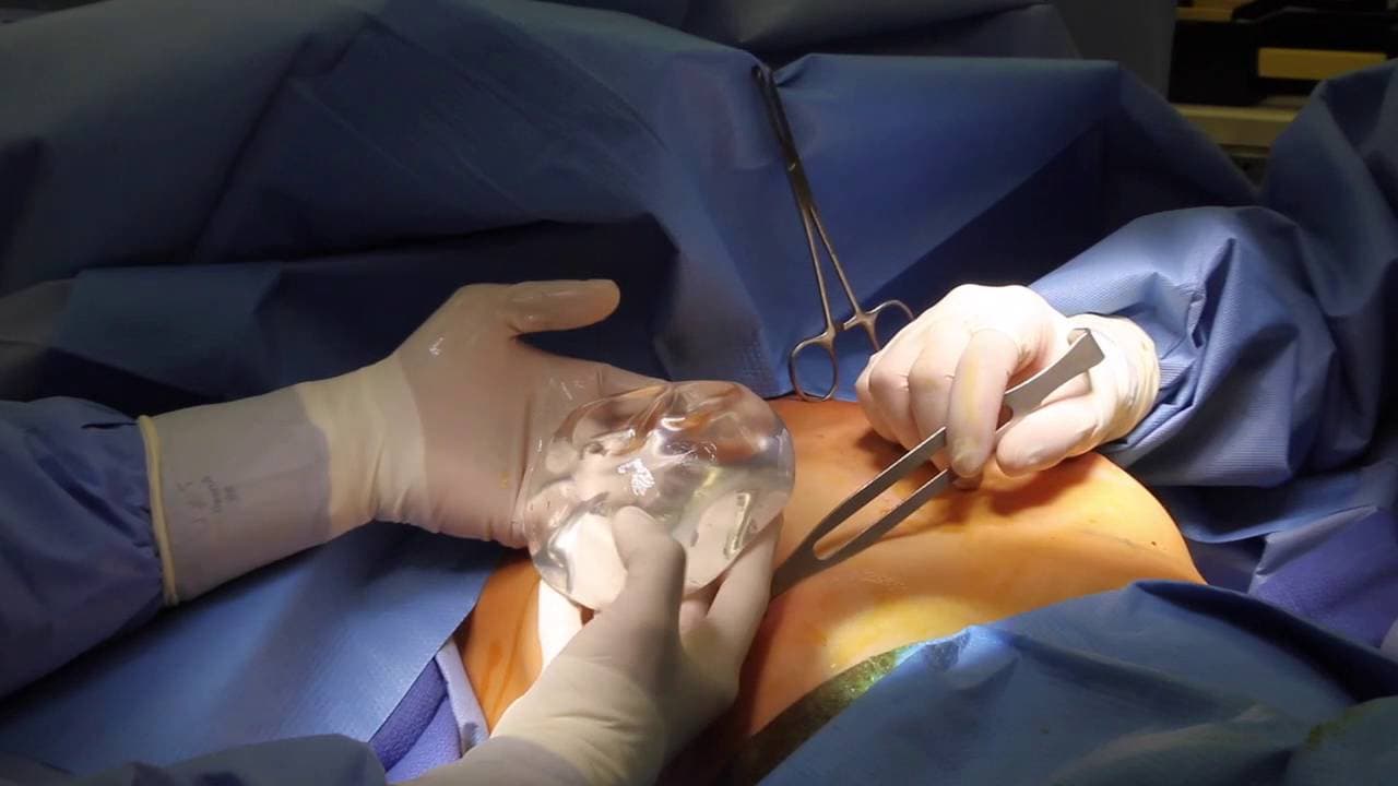 Ästhetische Chirurgie für Tubuläre Brust: Ihr Experte in Nordrhein-Westfalen