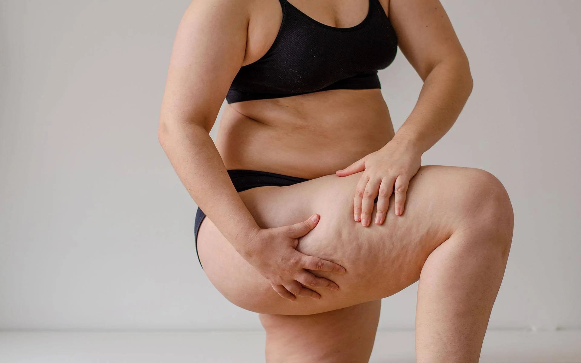 Lipödem-Therapie im Vergleich: Welche Methode ist die beste?